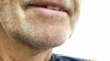 Stubble 2