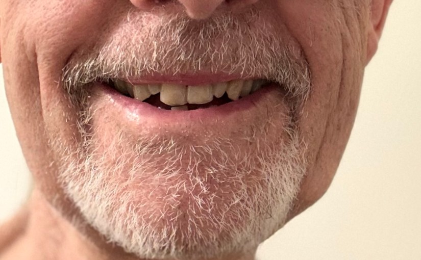 I’m That Guy #2: The Ubiquitous Bearded&nbsp;Chin